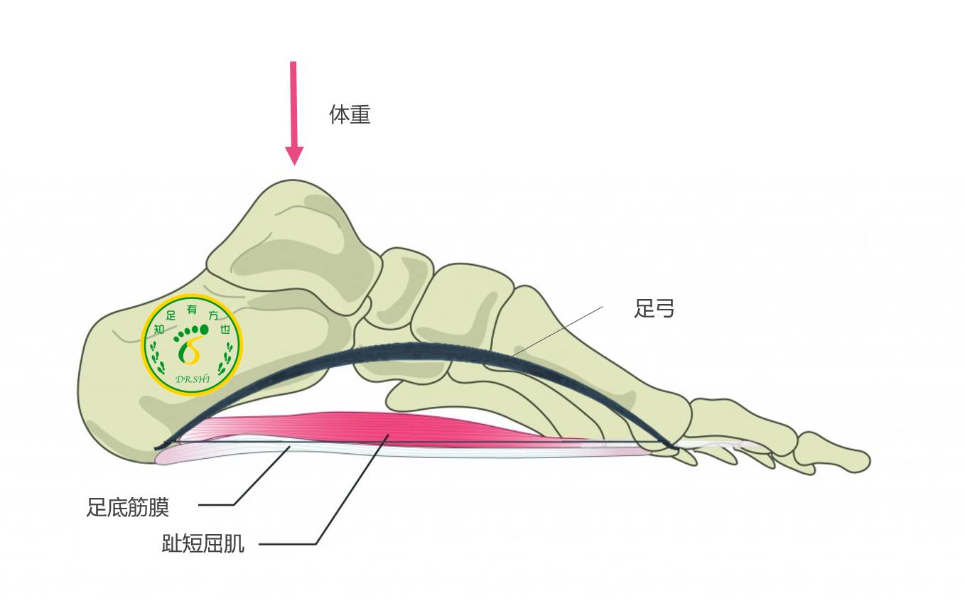  “足底筋膜炎”的重新认识和治疗