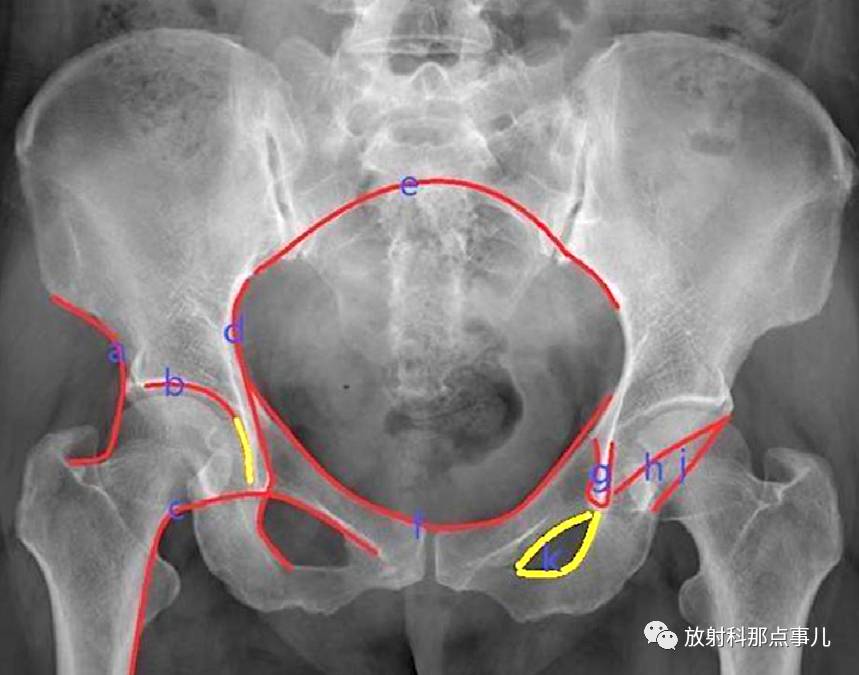 骨盆和髋关节的X线评估及测量大全