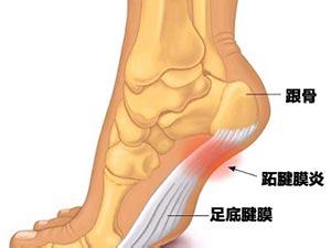 跖筋膜炎的关节镜治疗 --足跟痛