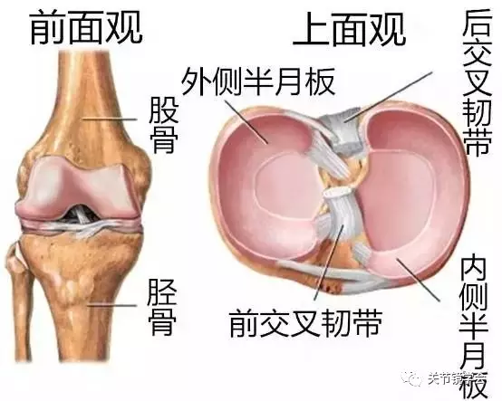 半月板的破裂类型及治疗方式