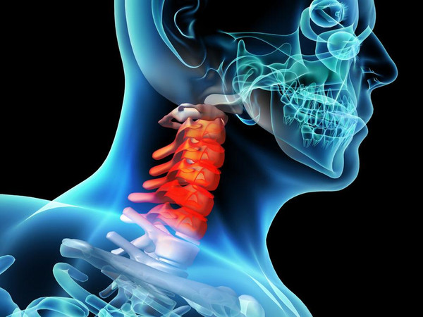 颈椎病的分型与治疗要点解析
