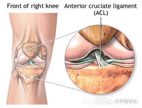 前交叉韧带自体腘绳肌腱重建术