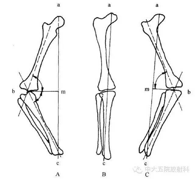 常见骨与关节的X线测量