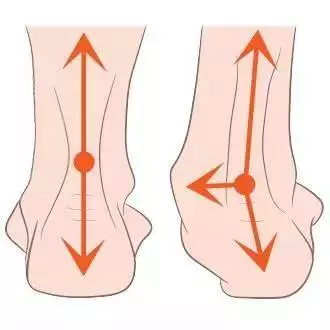 脚后跟痛是怎么回事？