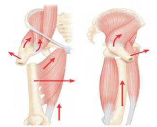 股骨粗隆下骨折髓内钉固定的复位技术