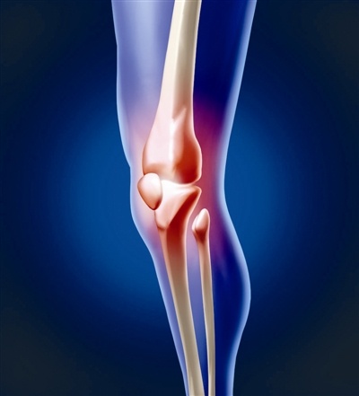 膝关节常见损伤的特征总结
