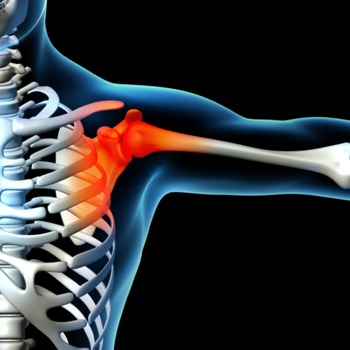 肩关节常见创伤性病变你了解多少？