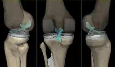 高清图解：磁共振下的膝关节