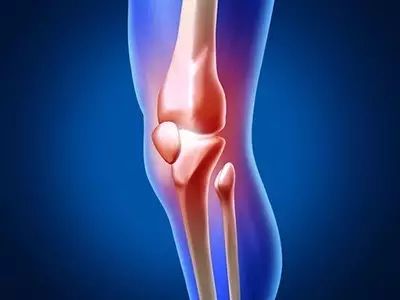 实用！膝关节疼痛你需要想到这22种疾病