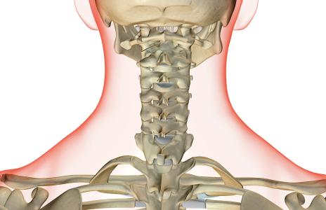 AAOS 2018：如何避免颈椎术后神经并发症？