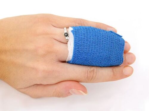 指端损伤的治疗原则及修复策略 