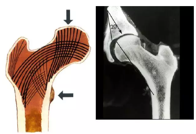 股骨颈骨折：从解剖到手术的全面阐述