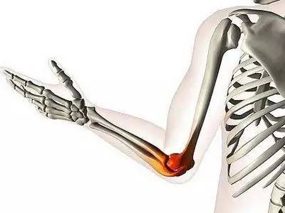 肘关节Y形成形术治疗肱骨远端粉碎性骨折