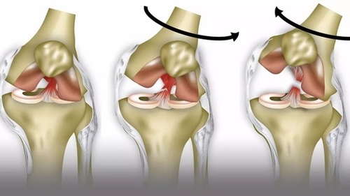 关节镜治疗胫骨髁间脊骨折的方法及技巧 