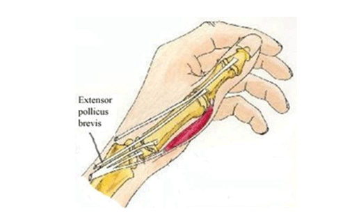 肌腱缝合术的原则及方法