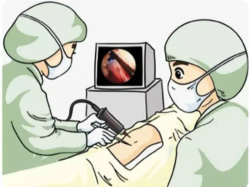 新技术！关节镜下骨软骨自体移植术治疗骨关节病
