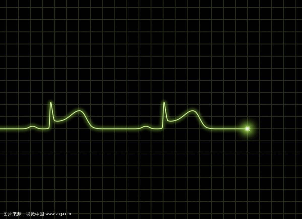 心电图危急值解读——急性冠脉综合征！