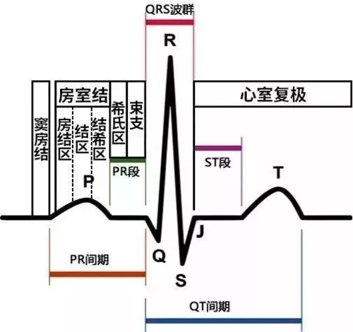 简易图解急性心梗的心电图演变