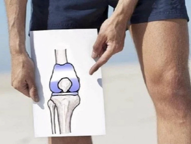 系统详解：人工膝关节置换术后疼痛原因分析