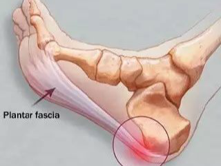 系统详解：踝关节骨折Lauge-Hansen分型