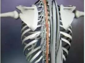 MRI关节间隙积液提示腰椎不稳