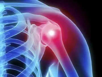 肩痛不一定是肩周炎，还有可能是肩袖损伤！
