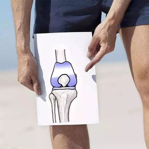 复杂初次全膝关节置换，遇到了该怎么办？