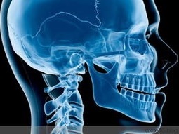 颅颈交界区脊柱损伤的影像评估，帮你整理好了！