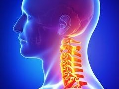 神经根型颈椎病——对肌节与皮节的影响