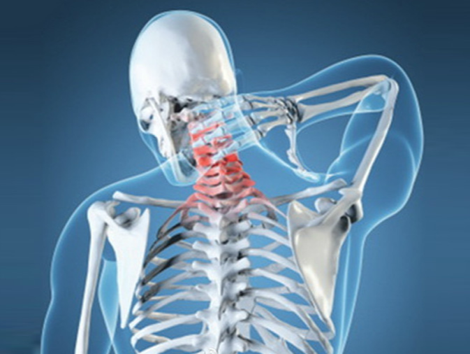 颈椎骨折--什么情况下需要干预？