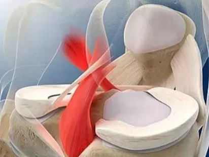 半月板损伤关节内及关节外各种缝合技术及应用