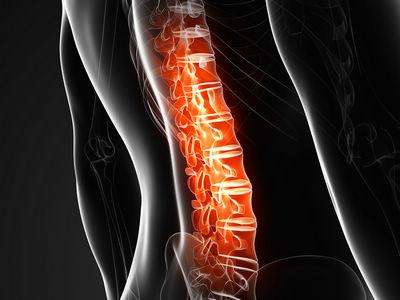 最新指南20问：成人急性胸腰段脊柱脊髓损伤！