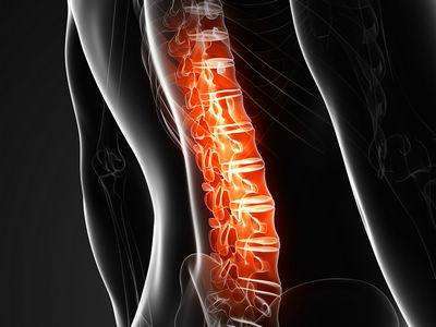 最新指南20问：成人急性胸腰段脊柱脊髓损伤！