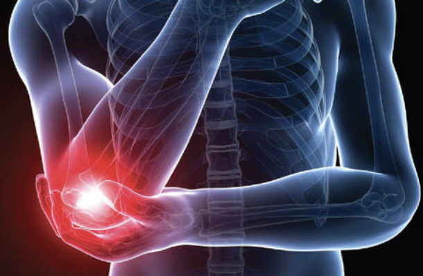 手把手教您：肱骨外上髁炎最佳诊治方案及康复训练！