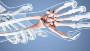 腕关节X线高清解剖图谱--最基础实用！
