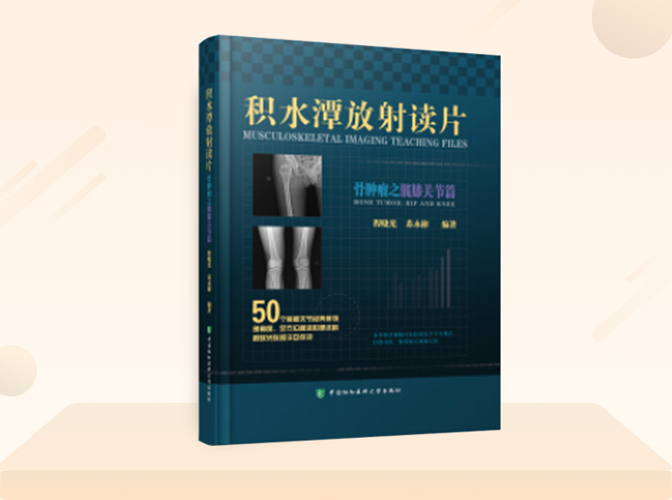 好书推荐：《积水潭放射读片-骨肿瘤之髋膝关节篇》，必备收藏！