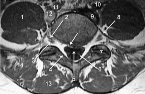 胸、腰椎MRI解剖，9张高清图注帮你速记!