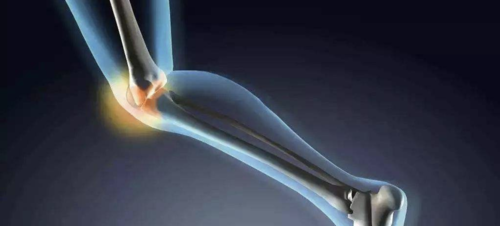 膝骨关节炎运动治疗临床实践指南，14条推荐请查收！