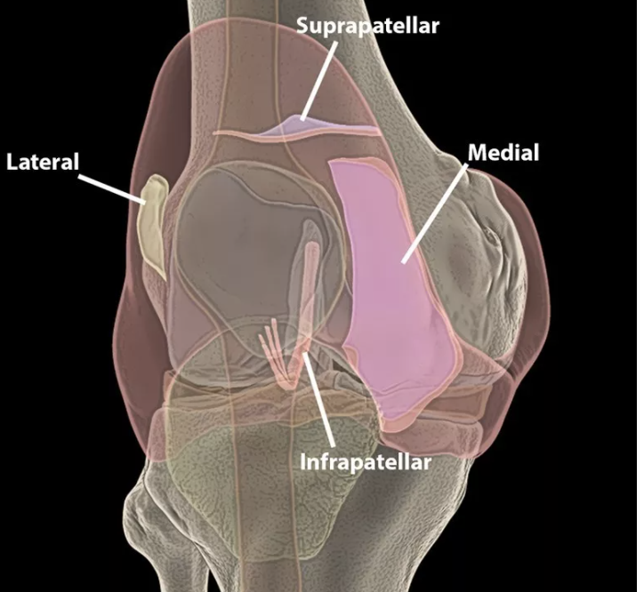 长期膝痛，除了关节炎更要警惕这个综合征！