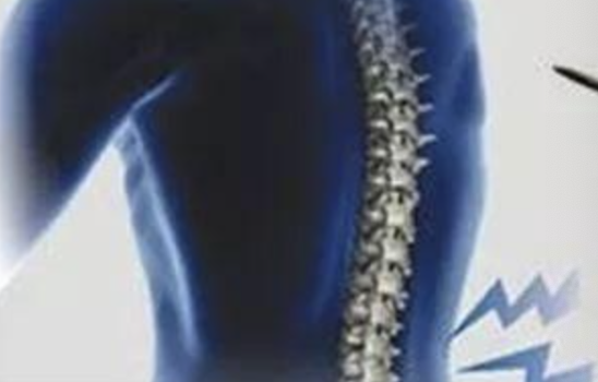 专家共识：腰椎间盘突出症诊疗推荐，解决你90%的难题！