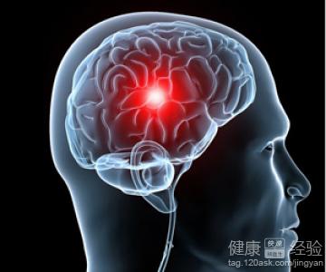 常见但不简单，这15种脑膜瘤你能诊断吗？