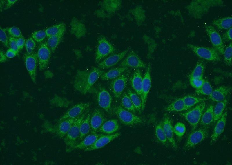 人源化IgG1单克隆抗体与依西美坦和依维莫司联合治疗晚期/转移性乳腺癌，是否有效？