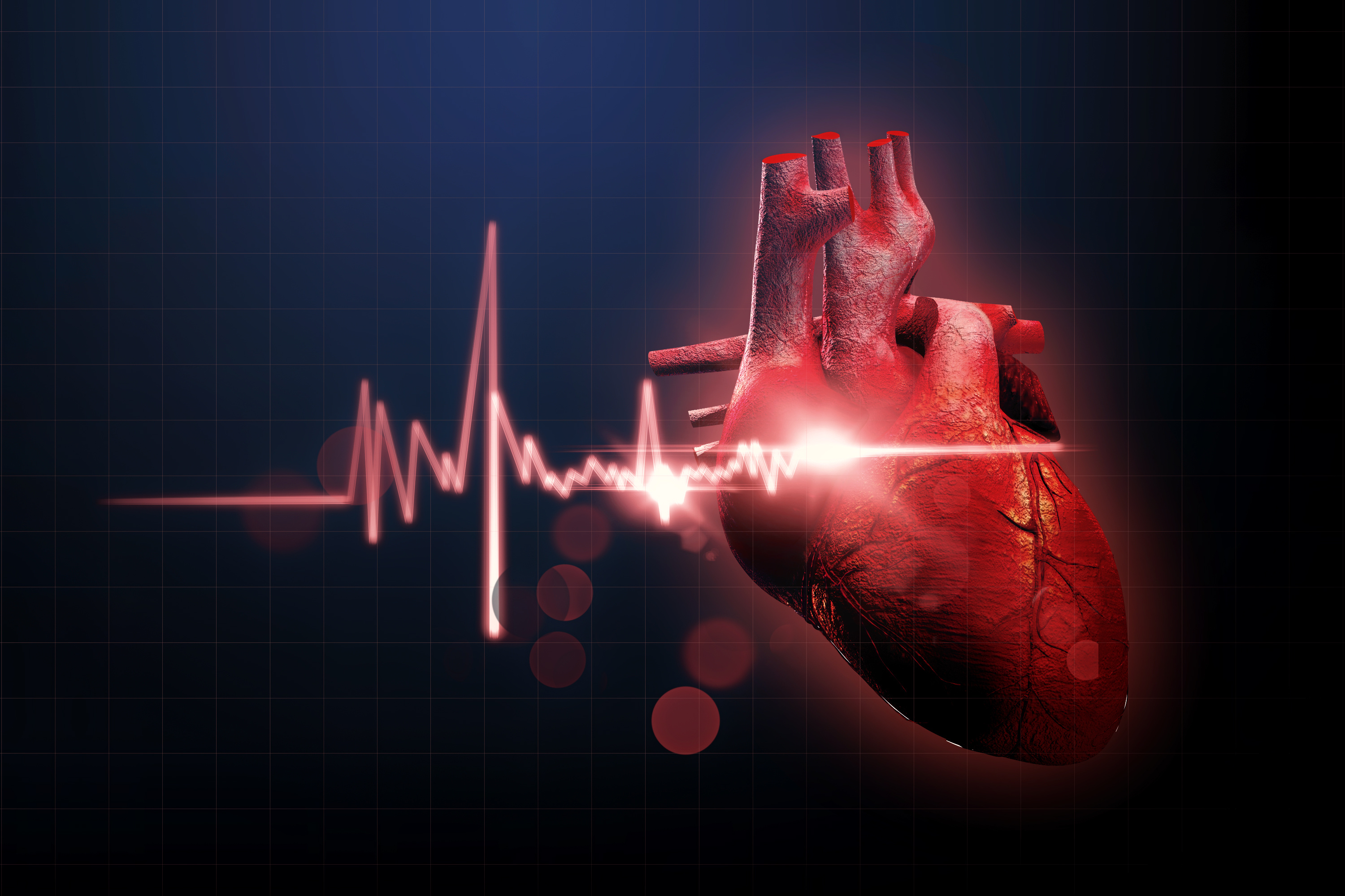 致命性心律失常的心电图你会判读吗？
