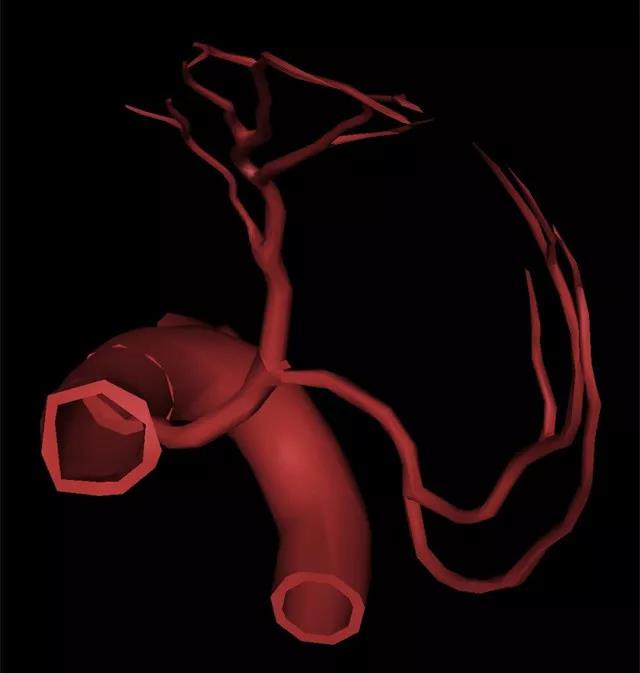  高清3D图片，轻松理解冠脉造影体位！