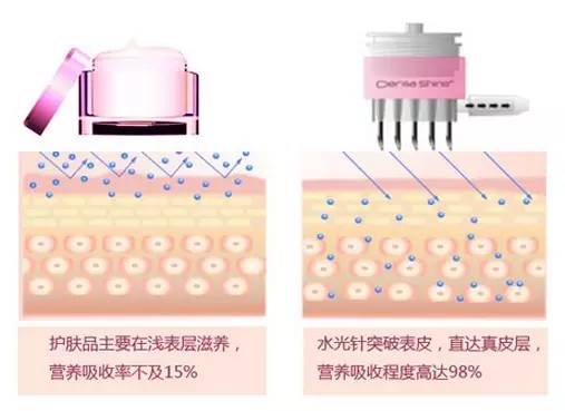 超值的水光注射配方及并发症处理方法！