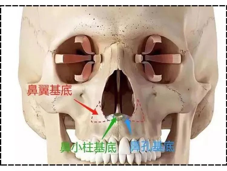 鼻基底整形的方法有哪些？