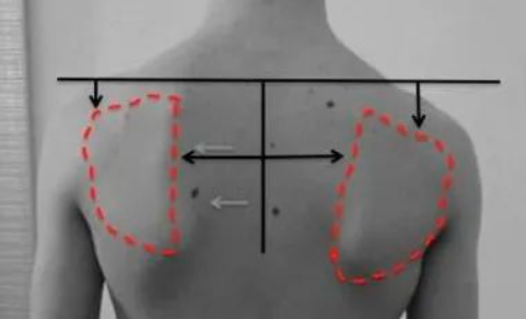 临床必备：肩胛下旋的疼痛评估实验