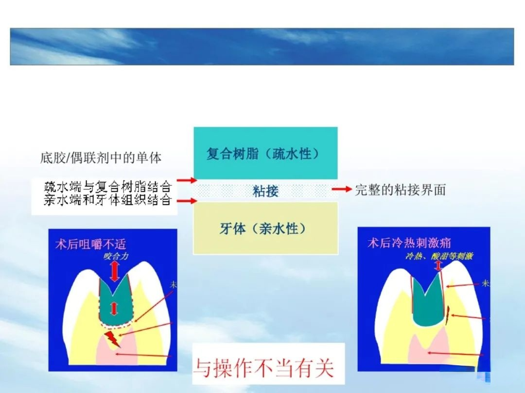 树脂充填后敏感的原因，这几点不可忽略！