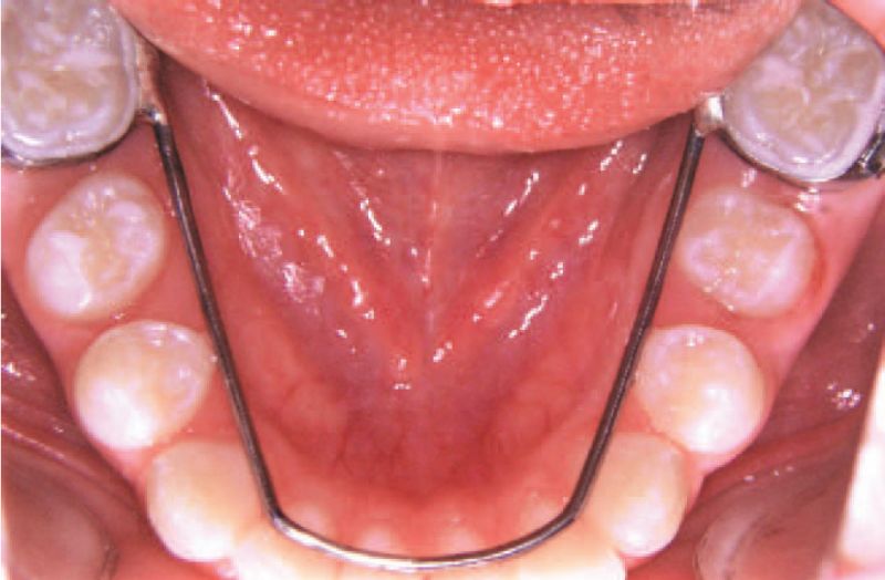 牙齿“晓”“技”|牙颌发育的7个阶段