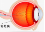 关于葡萄膜炎，这些你可能还不知道